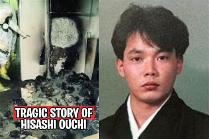 **The Tragic Story of Hisashi Ouchi: A Journey Through Pain and Suffering**
