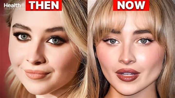 Transformations and Trends: Sabrina Carpenter Before and After Plastic Surgery
