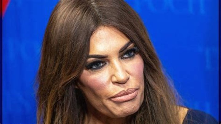 Unmasking the Reality: Is Kimberly Guilfoyle Truly Ugly?