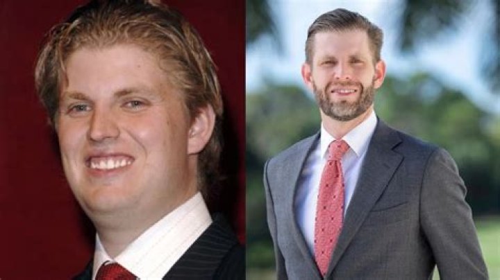 Unveiling the Truth Behind Eric Trump’s Plastic Surgery Rumors