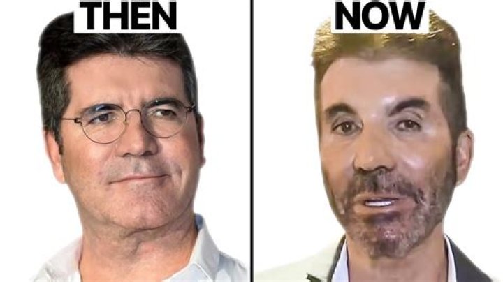 What Happened to Simon Cowell? The Truth Behind the Car Accident Rumors